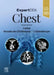 Expertddx: Chest by Brett W. Carter
