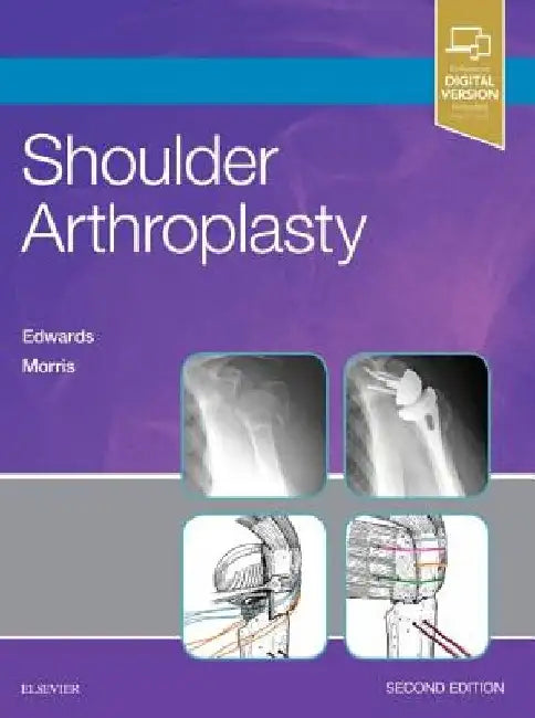 Shoulder Arthroplasty by T. Bradley Edwards