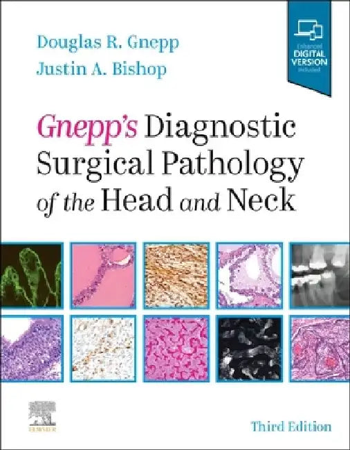 Gnepp's Diagnostic Surgical Pathology of the Head and Neck by Douglas R. Gnepp