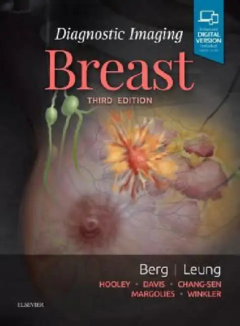 Diagnostic Imaging: Breast by Wendie A. Berg