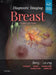 Diagnostic Imaging: Breast by Wendie A. Berg