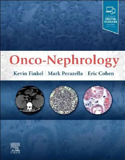 Onco-Nephrology by Kevin W. Finkel