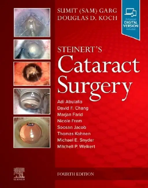 Steinert's Cataract Surgery by Sumit Garg