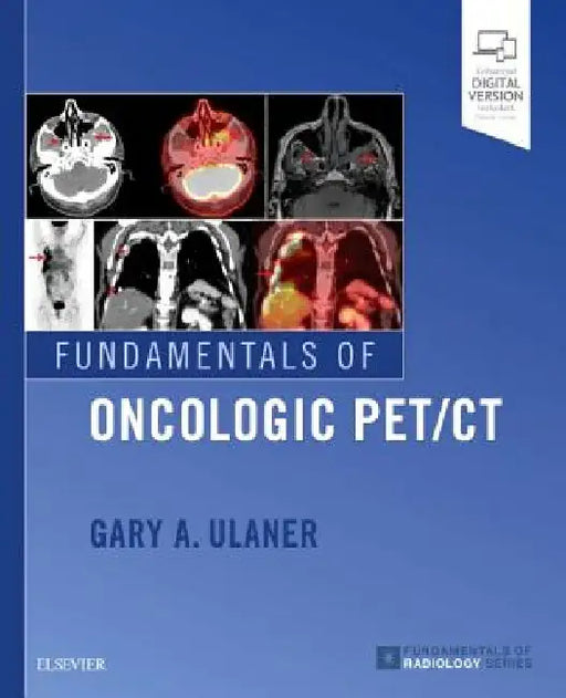 Fundamentals of Oncologic Pet/CT by Gary A. Ulaner