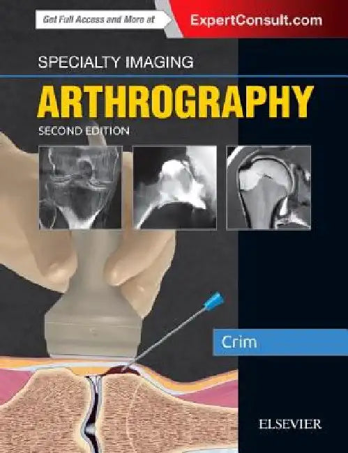 Specialty Imaging: Arthrography by Julia R. Crim