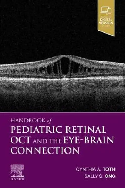 Handbook of Pediatric Retinal Oct and the Eye-Brain Connection by Cynthia A. Toth