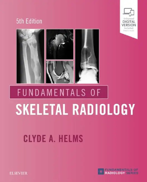 Fundamentals of Skeletal Radiology by Clyde A. (Professor of Radiology and Orthopaedic Surgery, Deparment of Radiology, Duke University School of Medicine, Durham, North Carolina) Helms