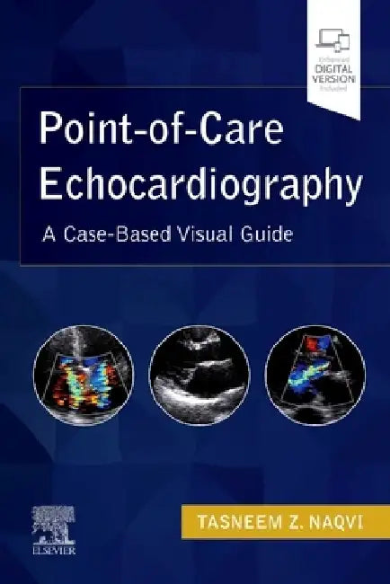 Point-Of-Care Echocardiography: A Clinical Case-Based Visual Guide by Tasneem Naqvi