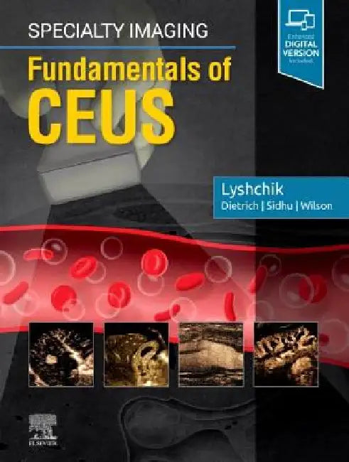 Specialty Imaging: Fundamentals of Ceus by Andrej Lyshchik