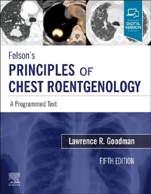 Felson's Principles of Chest Roentgenology, a Programmed Text: A Programmed Text by Lawrence R. Goodman