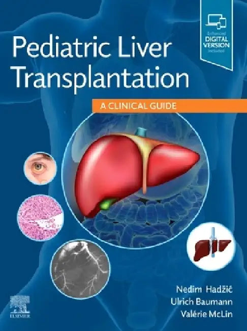 Pediatric Liver Transplantation: A Clinical Guide by Nedim Hadzic