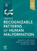 Smith's Recognizable Patterns of Human Malformation by Kenneth Lyons Jones