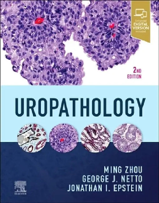 Uropathology by Ming Zhou