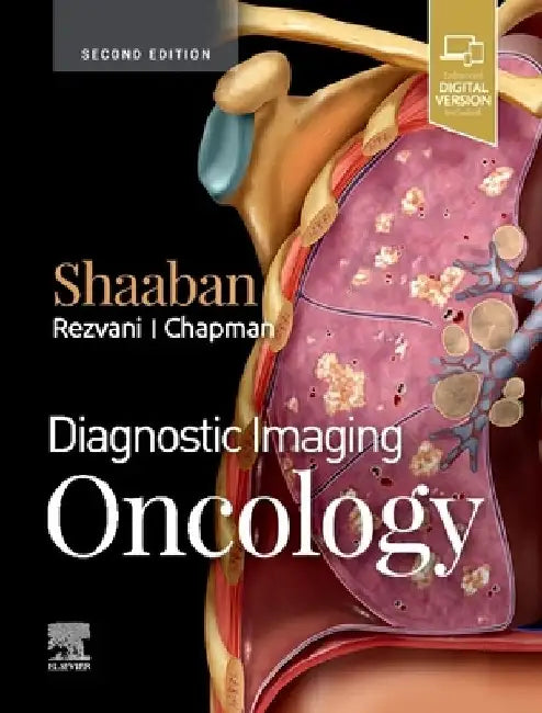 Diagnostic Imaging: Oncology by Akram M. Shaaban