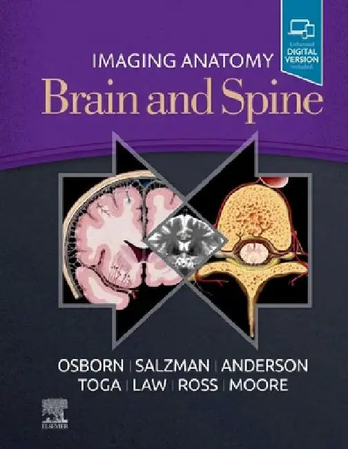Imaging Anatomy Brain and Spine by Anne G. Osborn