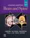 Imaging Anatomy Brain and Spine by Anne G. Osborn