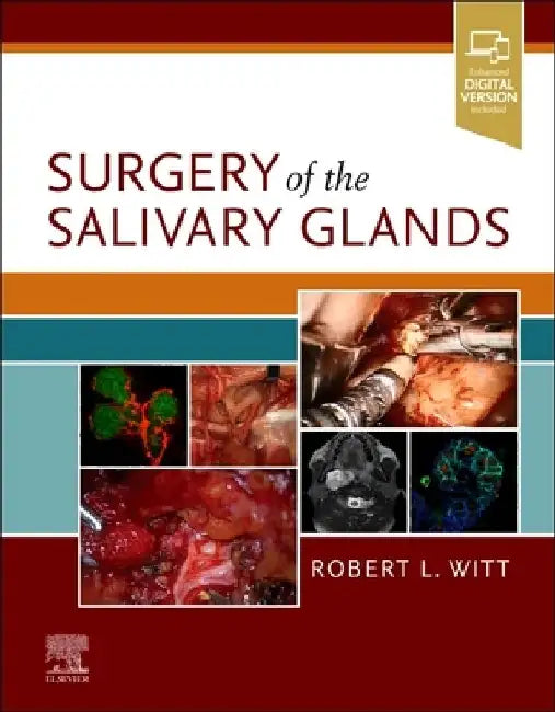 Surgery of the Salivary Glands by Robert L. Witt