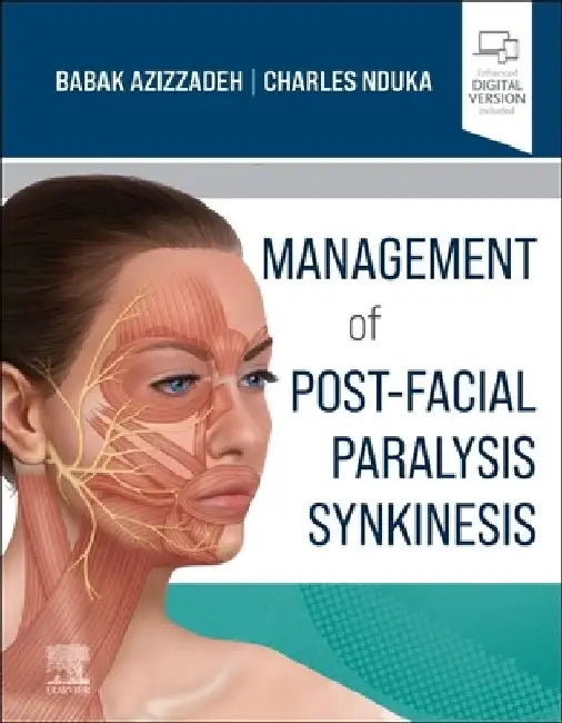 Management of Post-Facial Paralysis Synkinesis by Babak Azizzadeh