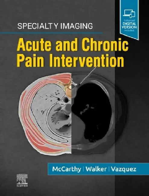 Specialty Imaging: Acute and Chronic Pain Intervention by Colin J. Mccarthy
