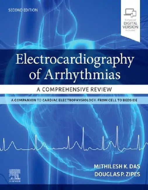 Electrocardiography of Arrhythmias: A Comprehensive Review by Mithilesh Kumar Das