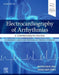 Electrocardiography of Arrhythmias: A Comprehensive Review by Mithilesh Kumar Das