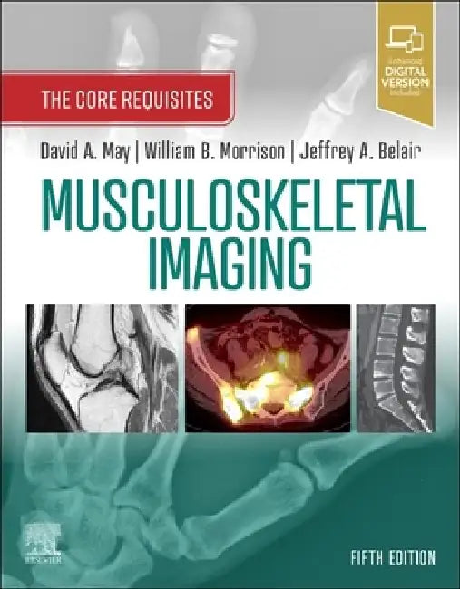 Musculoskeletal Imaging: The Core Requisites by David A. May
