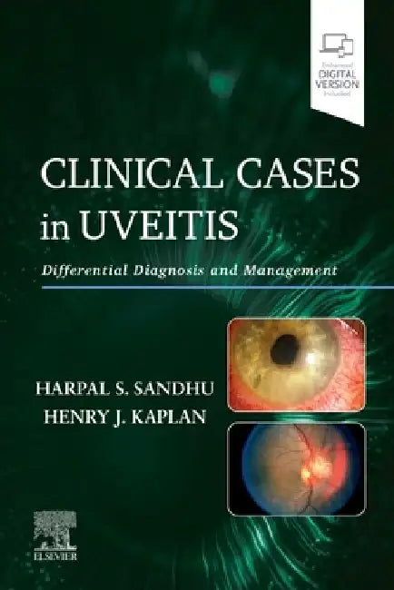 Clinical Cases in Uveitis: Differential Diagnosis and Management by Harpal Sandhu