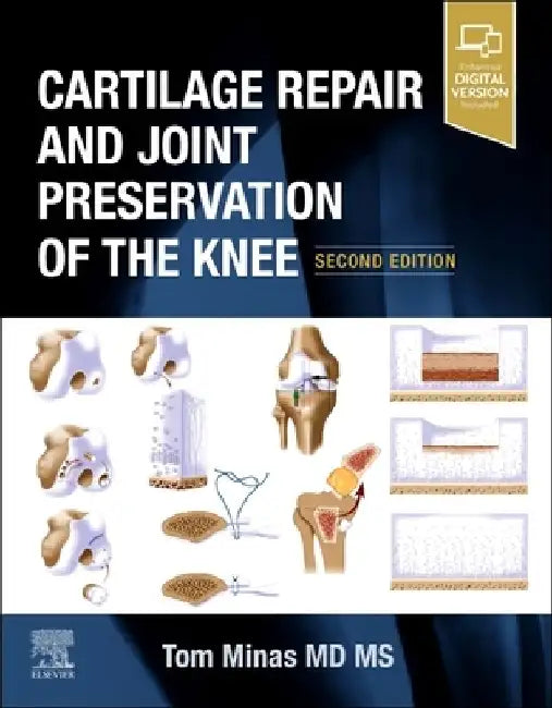 Cartilage Repair and Joint Preservation of the Knee by Tom Minas