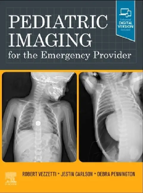 Pediatric Imaging for the Emergency Provider by Robert Vezzetti