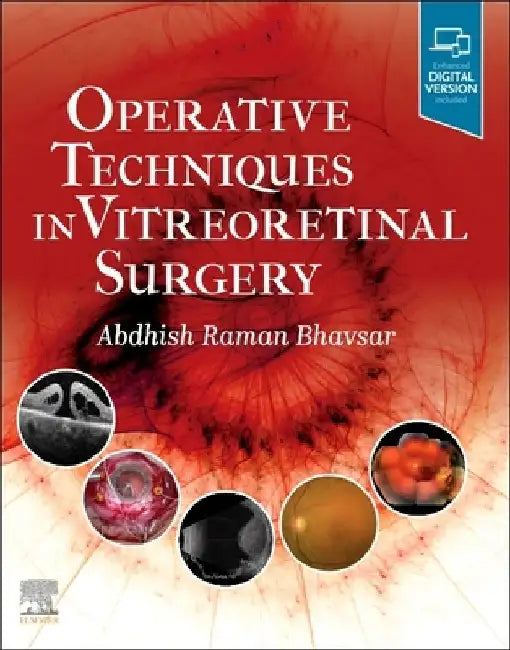 Operative Techniques in Vitreoretinal Surgery by Abdhish R. Bhavsar