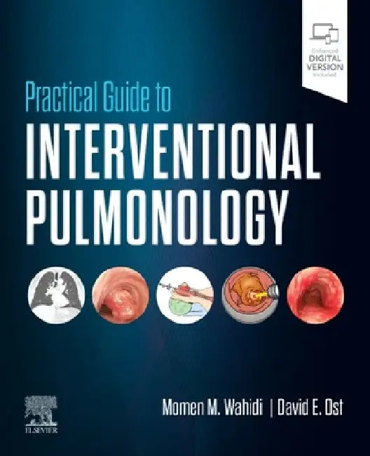 Practical Guide to Interventional Pulmonology by Momen M. Wahidi