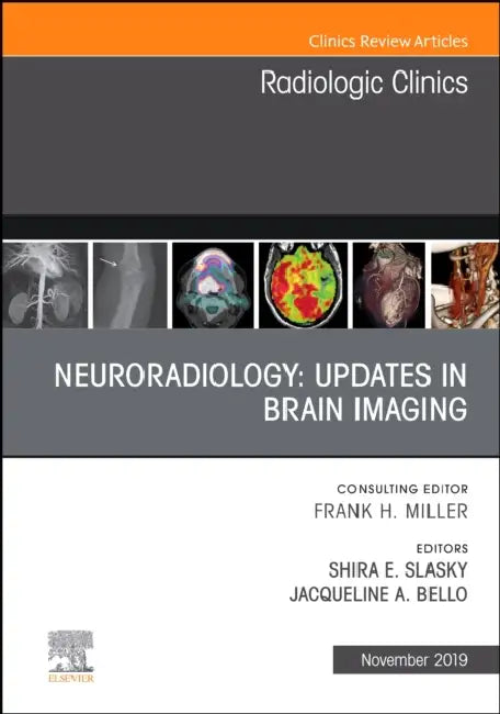 Neuroradiology, an Issue of Radiologic Clinics of North America: Volume 57-6 by Jacqueline A. Bello, Shira E. Slasky