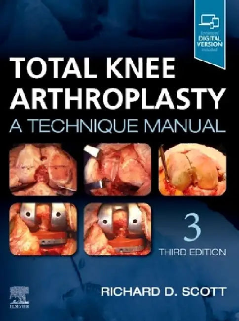 Total Knee Arthroplasty: A Technique Manual by Richard D. Scott