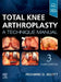 Total Knee Arthroplasty: A Technique Manual by Richard D. Scott