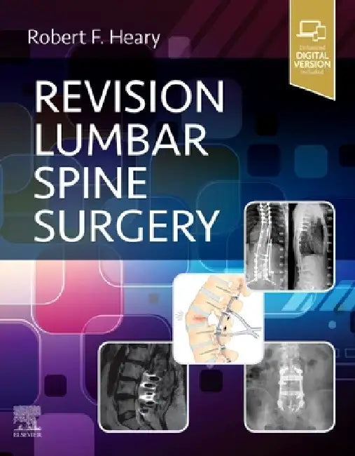 Revision Lumbar Spine Surgery by Robert F. Heary