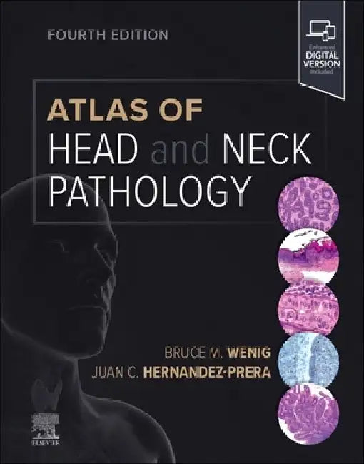 Atlas of Head and Neck Pathology by Bruce M. Wenig
