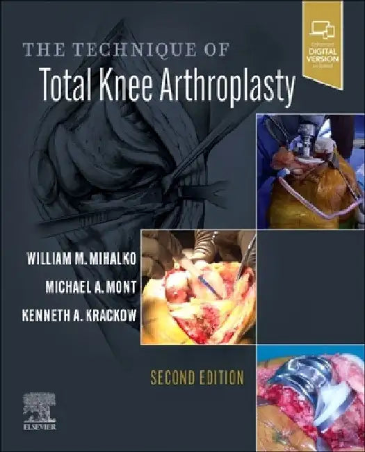 The Technique of Total Knee Arthroplasty by William M. Mihalko