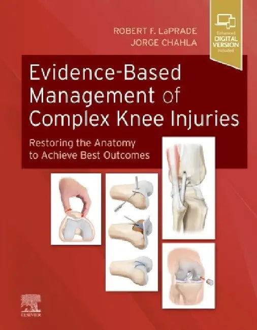 Evidence-Based Management of Complex Knee Injuries: Restoring the Anatomy to Achieve Best Outcomes by Robert F. Laprade