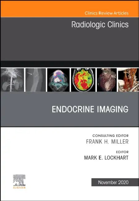 Endocrine Imaging, an Issue of Radiologic Clinics of North America: Volume 58-6 by Mark E. Lockhart