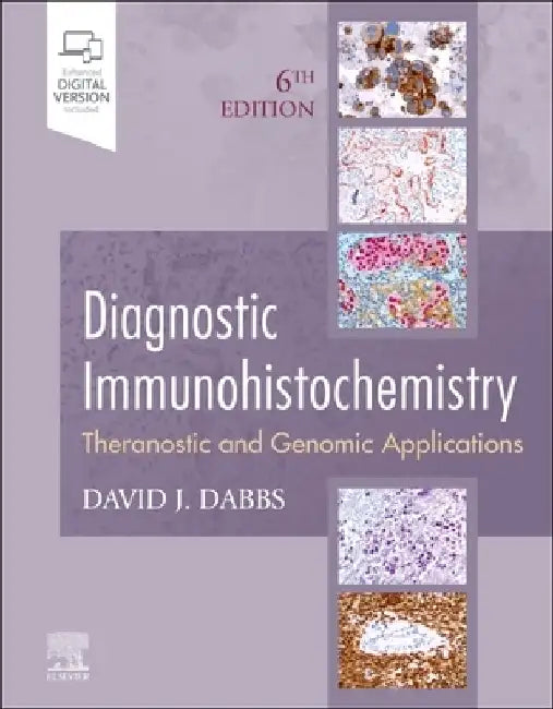 Diagnostic Immunohistochemistry: Theranostic and Genomic Applications by David J. Dabbs