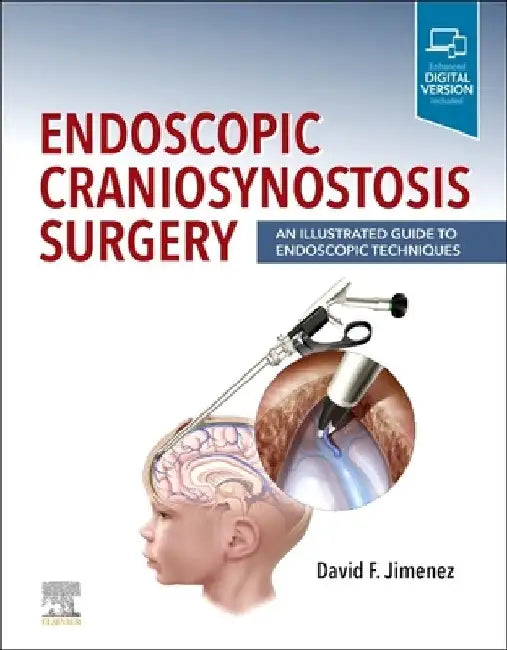 Endoscopic Craniosynostosis Surgery: An Illustrated Guide to Endoscopic Techniques by David F. Jimenez