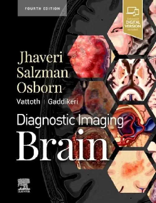 Diagnostic Imaging: Brain by Miral D. Jhaveri