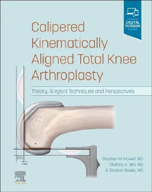 Calipered Kinematically Aligned Total Knee Arthroplasty: Theory, Surgical Techniques and Perspectives by Stephen M. Howell