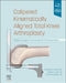 Calipered Kinematically Aligned Total Knee Arthroplasty: Theory, Surgical Techniques and Perspectives by Stephen M. Howell