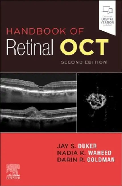 Handbook of Retinal Oct: Optical Coherence Tomography by Jay S. Duker