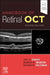 Handbook of Retinal Oct: Optical Coherence Tomography by Jay S. Duker
