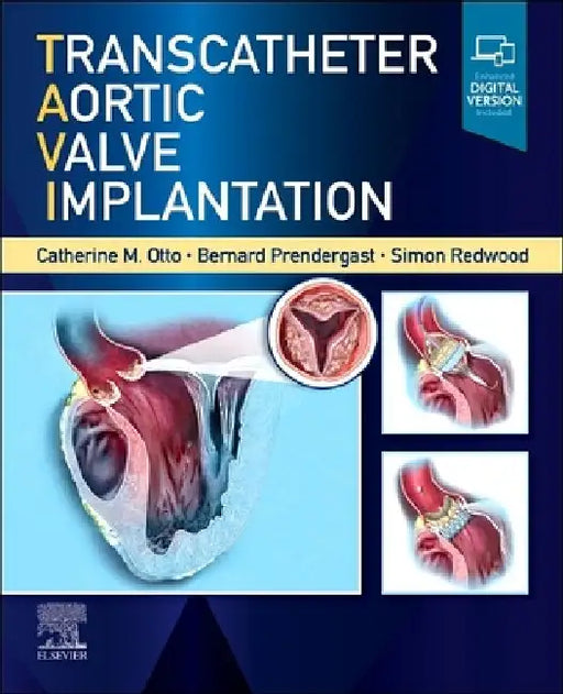 Transcatheter Aortic Valve Implantation by Catherine M. Otto