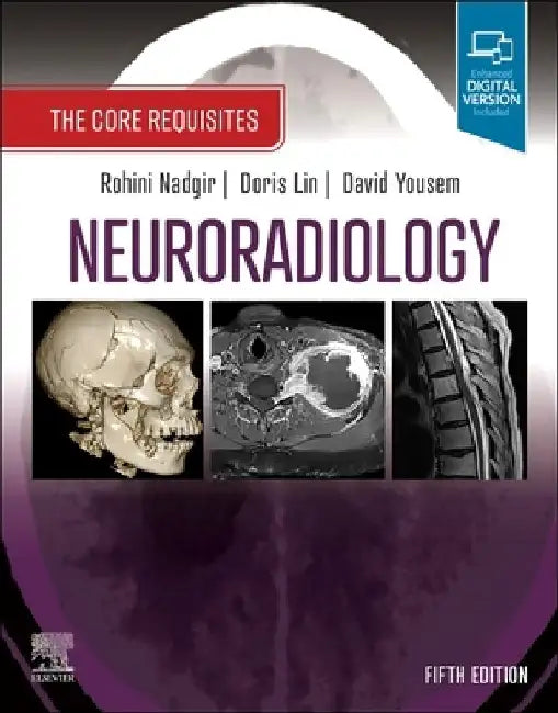 Neuroradiology: The Core Requisites by Rohini Nadgir