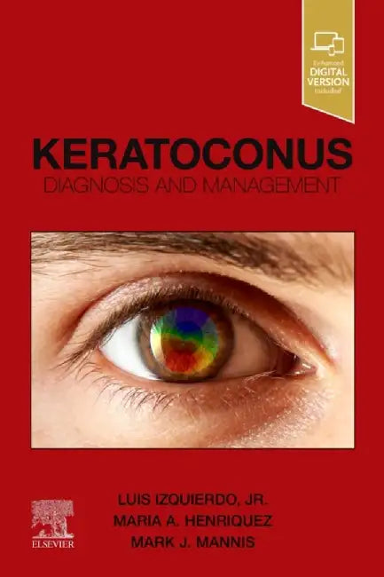 Keratoconus: Diagnosis and Management by Luis Izquierdo