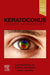 Keratoconus: Diagnosis and Management by Luis Izquierdo